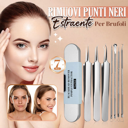 💓58% DI SCONTO💥Kit Strumento Rimuovi Punti Neri e Estraente per Brufoli